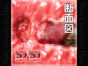 [RE200844] Sectional View of Vaginal for Haru